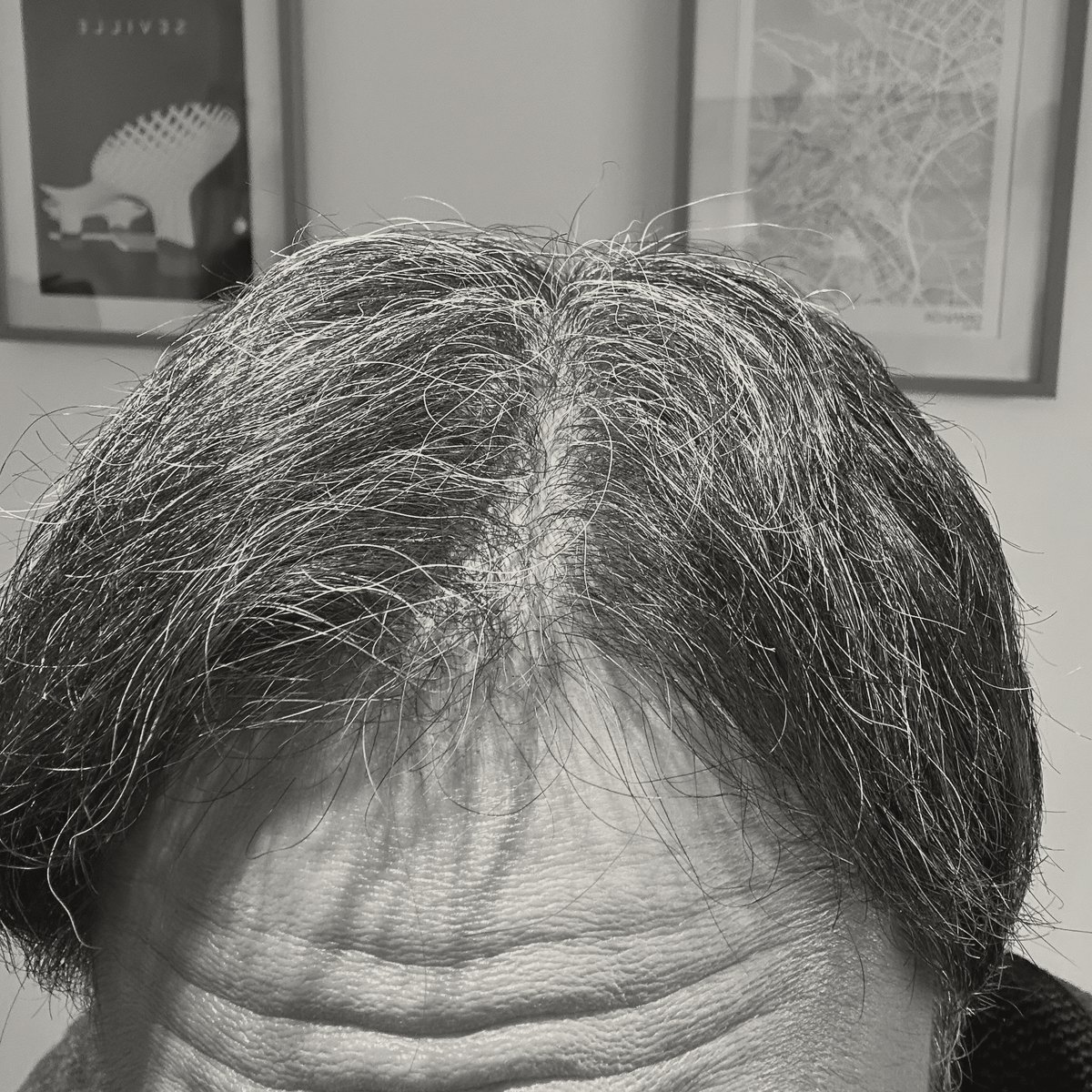 The baseline photograph, 25 October 2026: the top of the author&rsquo;s head seen from the front, dark hair streaked with grey, finer and thinner along a centre parting where the scalp shows through, with a lined forehead below and two framed prints on the wall behind.